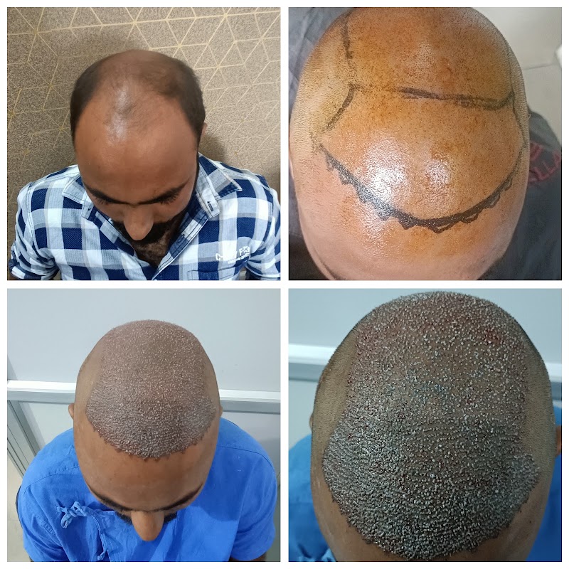 AHT Hair clinic, jagatpura , jaipur