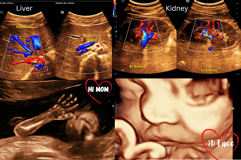 Spectra Imaging and Diagnostic Clinic| 4D sonography| HSG| 2D-Echo| Penile Doppler| Health Package| Lab test in Pratap Nagar